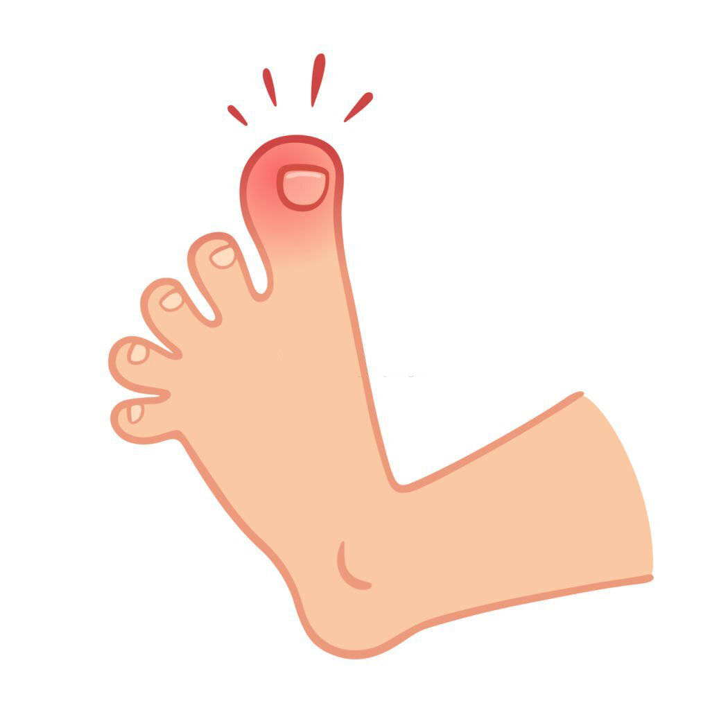 toe